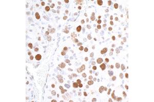 Immunohistochemistry (IHC) image for anti-Importin Subunit alpha-1 (KPNA2) (C-Term) antibody (ABIN7453571) (Importin Subunit alpha-1 (KPNA2) (C-Term) Antikörper)