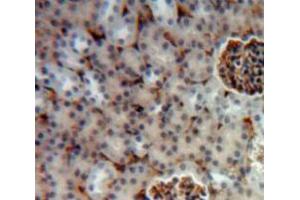 Used in DAB staining on fromalin fixed paraffin-embedded Kidney tissue (Hexosaminidase A Antikörper  (AA 318-529))