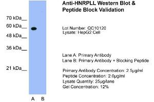Western Blotting (WB) image for anti-Heterogeneous Nuclear Ribonucleoprotein L-Like (HNRPLL) (N-Term) antibody (ABIN2776622)
