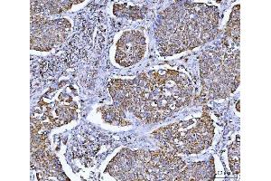 IHC analysis of GLUD1/2 using anti-GLUD1/2 antibody (ABIN7602000). (GLUD1 / GLUD2 (AA 54-553) Antikörper)