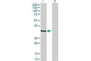 Western Blotting (WB) image for anti-Zinc Finger Protein 397 (ZNF397) (AA 131-231) antibody (ABIN599599) (ZNF397 Antikörper  (AA 131-231))