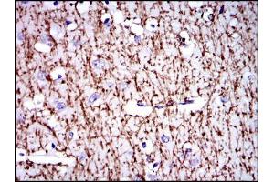 Immunohistochemical analysis of paraffin-embedded brain tissues using MBP mouse mAb with DAB staining.