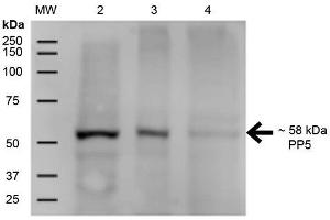 Western Blot analysis of Human A431, HEK293, and Jurkat cell lysates showing detection of ~58 kDa PP5 protein using Mouse Anti-PP5 Monoclonal Antibody, Clone 12F7 . (PP5 Antikörper  (APC))