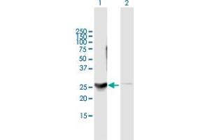 Western Blot analysis of DENR expression in transfected 293T cell line by DENR MaxPab polyclonal antibody. (Density Regulated Protein Antikörper  (AA 1-198))