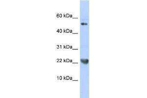 Western Blotting (WB) image for anti-Tumor Necrosis Factor (Ligand) Superfamily, Member 12 (TNFSF12) (N-Term) antibody (ABIN2774826)
