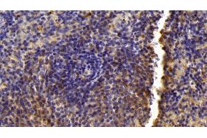 Detection of LXRb in Mouse Spleen Tissue using Polyclonal Antibody to Liver X Receptor Beta (LXRb) (NR1H2 Antikörper  (AA 1-446))