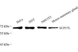 Western blot analysis of SUPT7L (ABIN7075768) at dilution of 1: 2000