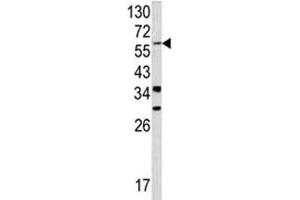 Western blot analysis of YAP antibody and NCI-H460 lysate.