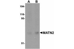 Image no. 1 for anti-Matrilin 2 (MATN2) (C-Term) antibody (ABIN478061) (MATN2 Antikörper  (C-Term))