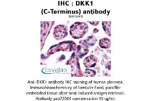 Image no. 1 for anti-Dickkopf Homolog 1 (DKK1) (C-Term) antibody (ABIN1733668) (DKK1 Antikörper  (C-Term))