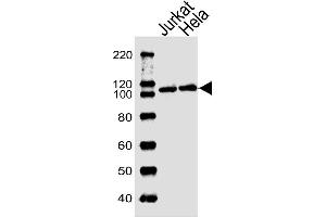 Lane 1: Jurkat Cell lysates, Lane 2: HeLa Cell lysates, probed with USP11 (1220CT620.