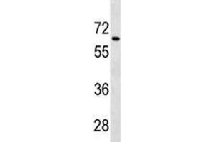 Tgfbr2 antibody western blot analysis in 293 lysate.