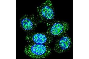 Immunofluorescence (IF) image for anti-Acid Phosphatase 1, Soluble (ACP1) antibody (ABIN3004169)