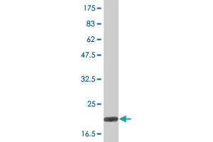 Western Blotting (WB) image for anti-Lymphotoxin-alpha (LTA) (AA 58-205) antibody (DYKDDDDK Tag,His tag) (ABIN2752650)