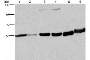 Western Blot analysis of Human fetal liver and testis tissue, 293T and A172 cell, Mouse brain and Human fetal brain tissue using MCHR1 Polyclonal Antibody at dilution of 1:350 (MCHR1 Antikörper)