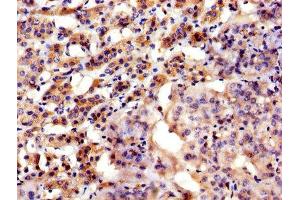 IHC image of ABIN7144757 diluted at 1:300 and staining in paraffin-embedded human adrenal gland tissue performed on a Leica BondTM system. (Aspartate beta Hydroxylase Antikörper  (AA 75-270))