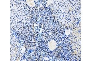 Immunohistochemistry of paraffin-embedded Rat ovary using Myogenin Polyclonal Antibody at dilution of 1:100 (20x lens). (Myogenin Antikörper)