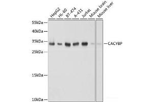 Western blot analysis of extracts of various cell lines using CACYBP Polyclonal Antibody at dilution of 1:1000. (CACYBP Antikörper)