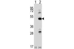 Western blot analysis of ILK antibody and 293 cell lysate either nontransfected (Lane 1) or transiently transfected (2) with the ILK gene. (ILK Antikörper  (AA 225-253))