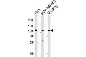 Western Blotting (WB) image for anti-Nuclear Receptor Coactivator 7 (NCOA7) antibody (ABIN3004220) (NCOA7 Antikörper)