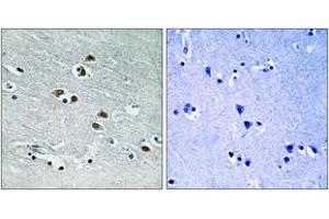 Immunohistochemistry analysis of paraffin-embedded human brain tissue, using HDAC6 (Ab-22) Antibody. (HDAC6 Antikörper  (AA 7-56))