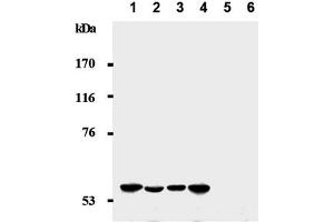 Western Blotting (WB) image for anti-Cyclin-Dependent Kinase Inhibitor 1C (p57, Kip2) (CDKN1C) antibody (ABIN487486) (CDKN1C Antikörper)