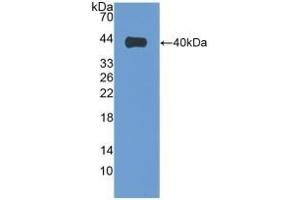 Detection of Recombinant VIL1, Human using Polyclonal Antibody to Villin (VIL) (Villin 1 Antikörper  (AA 1-320))