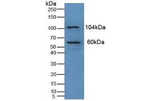 Detection of PKN1 in Human Liver Tissue using Polyclonal Antibody to Protein Kinase N1 (PKN1) (PKN1 Antikörper  (AA 615-874))