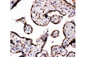 IHC-P: Aromatase antibody testing of human placenta tissue (Aromatase Antikörper  (C-Term))