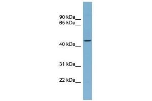 FBXO4 antibody used at 1 ug/ml to detect target protein. (FBXO4 Antikörper  (Middle Region))
