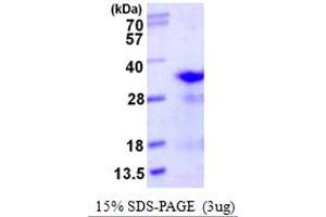 Ribosomal Protein L8 (RPL8) (AA 1-257) protein (His tag)