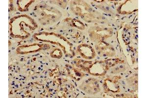 Immunohistochemistry (IHC) image for anti-Protein Phosphatase 2, Catalytic Subunit, beta Isozyme (PPP2CB) (AA 1-309), (Catalytic Subunit beta) antibody (ABIN7169270)