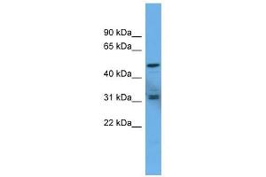 Western Blot showing ADCYAP1R1 antibody used at a concentration of 1-2 ug/ml to detect its target protein. (ADCYAP1R1 Antikörper  (C-Term))