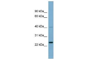 WB Suggested Anti-HSPC111  Antibody Titration: 0.