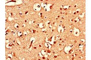 Immunohistochemistry of paraffin-embedded human brain tissue using ABIN7144784 at dilution of 1:100 (Ataxin 1-Like Antikörper  (AA 183-463))