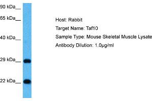 Host: Mouse Target Name: TAF10 Sample Tissue: Mouse Skeletal Muscle Antibody Dilution: 1ug/ml (TAF10 Antikörper  (Middle Region))