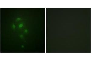 Immunofluorescence analysis of A549 cells, using MSK1 (Phospho-Thr581) Antibody. (MSK1 Antikörper  (pThr581))