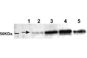 Western Blotting (WB) image for anti-Amylase, alpha (AMY) antibody (ABIN619546) (Amylase, alpha Antikörper)