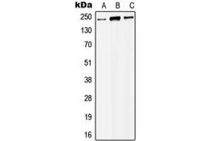 Western blot analysis of MYST4 expression in HEK293T (A), Raw264. (KAT6B Antikörper  (Center))