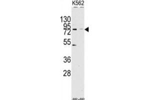 Western Blotting (WB) image for anti-Lysine (K)-Specific Demethylase 2A (KDM2A) antibody (ABIN2995648) (KDM2A Antikörper)
