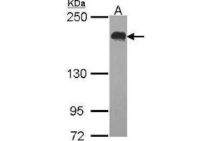 WB Image Sample (30 ug of whole cell lysate) A: Hela 5% SDS PAGE USP47 antibody antibody diluted at 1:1000 (USP47 Antikörper)