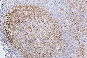 IHC analysis of CDK1 using anti-CDK1 antibody (ABIN7602240). (CDK1 Antikörper  (AA 66-297))