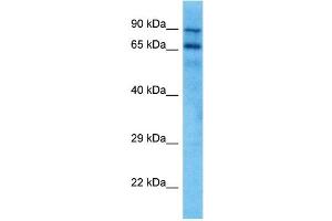 Host:  Mouse  Target Name:  KCND3  Sample Tissue:  Mouse Spleen  Antibody Dilution:  1ug/ml (KCND3 Antikörper  (C-Term))