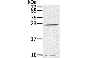 Western blot analysis of K562 cell, using SSX1 Polyclonal Antibody at dilution of 1:350 (SSX1 Antikörper)