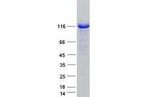 Validation with Western Blot