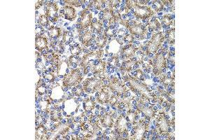 Immunohistochemistry of paraffin-embedded rat kidney using COPS2 antibody at dilution of 1:100 (x400 lens). (COPS2 Antikörper)