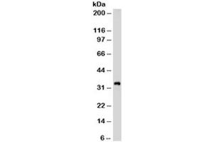 Western blot testing of Jurkat cell lysate with CD99 antibody (clone HO36-1. (CD99 Antikörper)