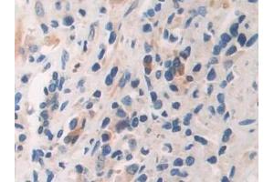 Immunohistochemistry (IHC) image for anti-Arrestin, beta 1 (ARRB1) (AA 3-246) antibody (ABIN7441790)