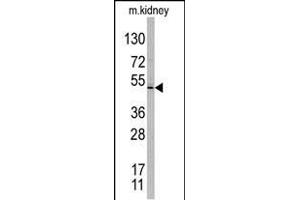 TASP1 Antikörper  (C-Term)