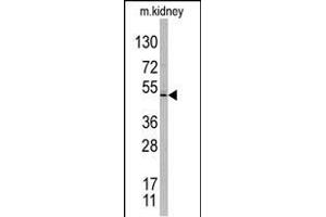Western blot analysis of TASP1 C-term polyclonal antibody (ABIN388126 and ABIN2846334) in mouse kidney tissue lysates.